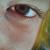 Augen....blick mal von